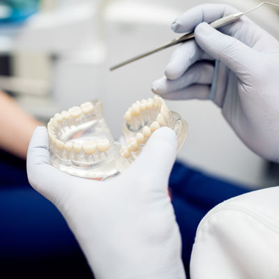 Overdenture