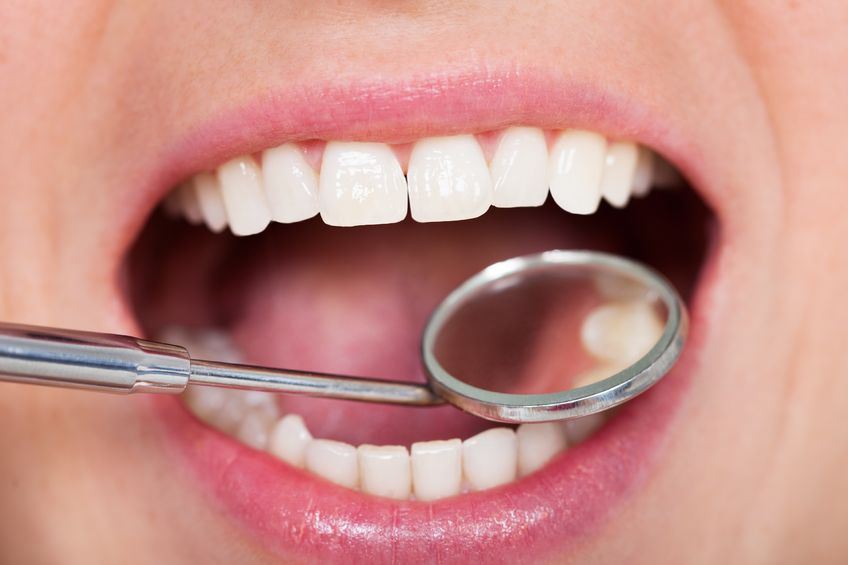 What a Dental Check-Up and Cleaning Involves