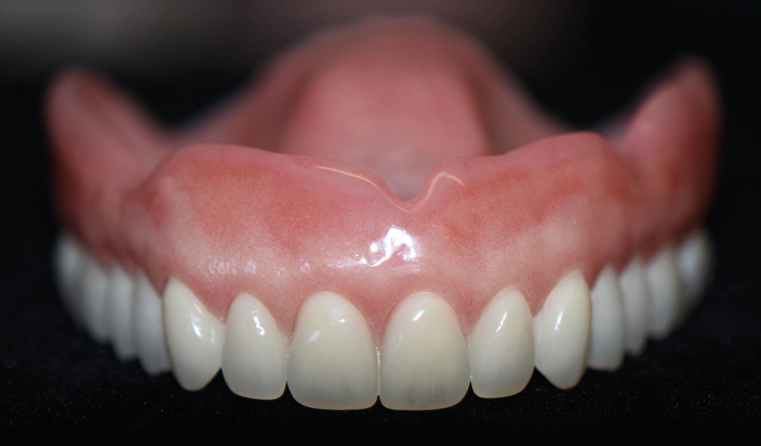 How to Properly Care for Your Dentures