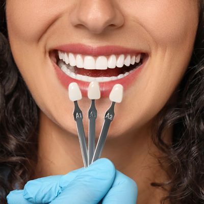 Cosmetic Dentistry