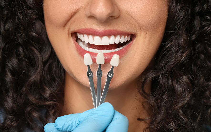 cosmetic-dentistry-img2