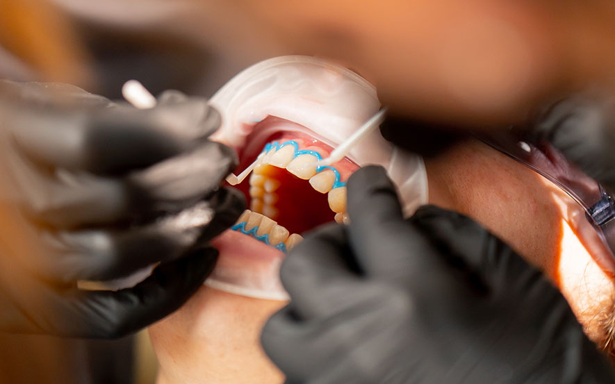 dental-implants-image1