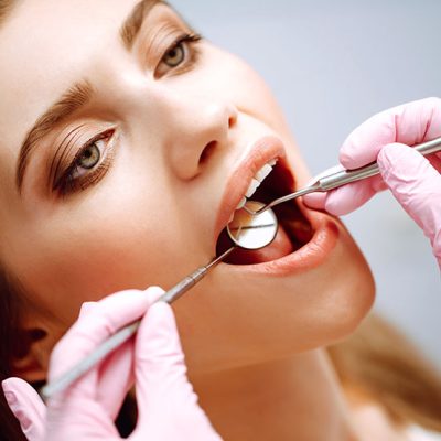 Scale clean/Oral Hygiene