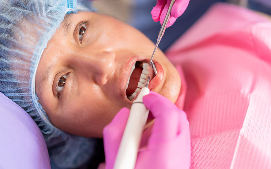dental-scale-and-clean-image2