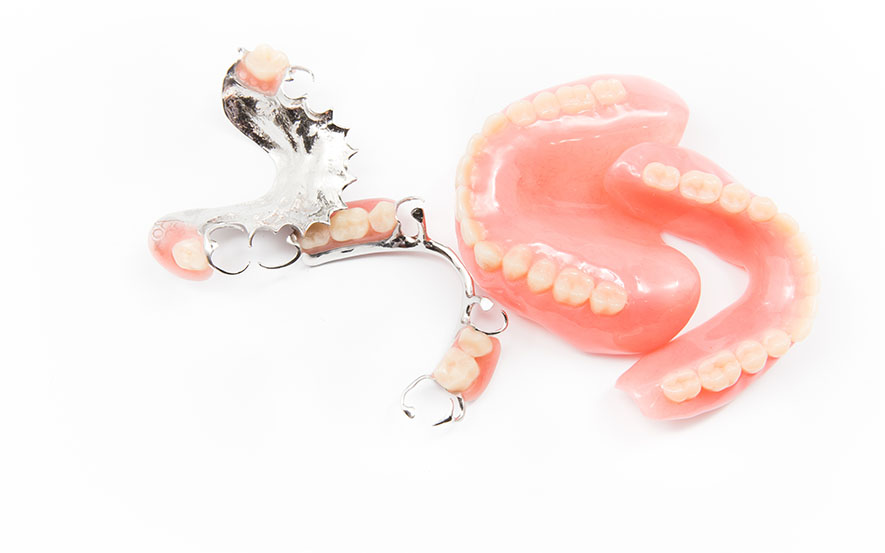 full-and-partial-dentures-img1