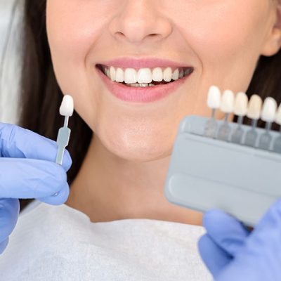 Gum Contouring