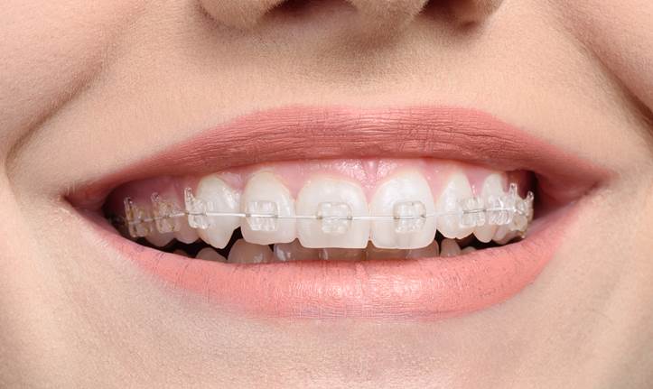 4 Tips for Easing a Toothache at Home